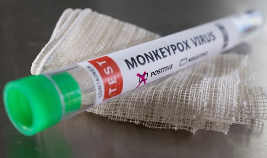 Monkeypox Test cheap health publicity