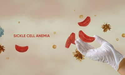 sickle cell disease